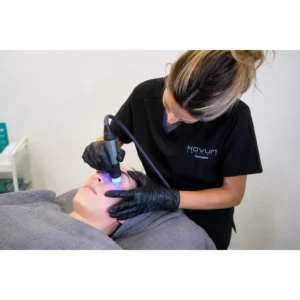 Esteticista trabajando con ultradeep